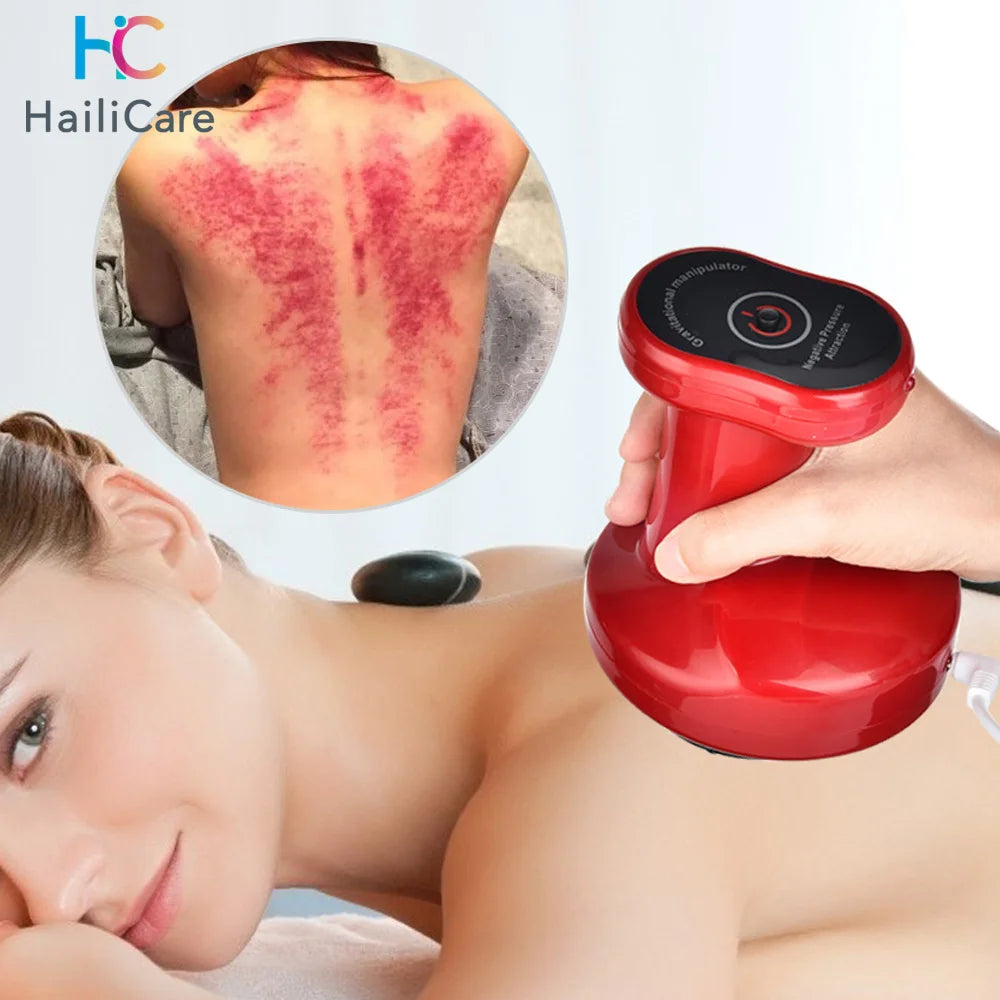Aparelho de Ventosaterapia Elétrico Inteligente a Vácuo com Aquecimento Infravermelho – Massageador Corporal Anticelulite para Costas, Pescoço e Braços